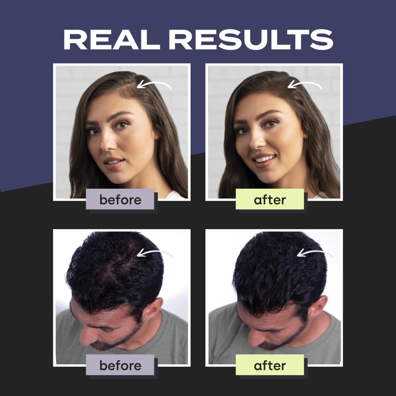 Jashiya Toppik Hair Building Fibers, Keratin-Derived Fibres for Naturally Thicker Looking Hair, Cover bald spot - Black 27.5 gm with Spray Applicator, Combo Pack